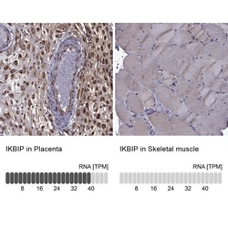 IKIP Antibody, Novus Biologicals 25 &mu;L, Unconjugated:Antibodies, Polyclonal
